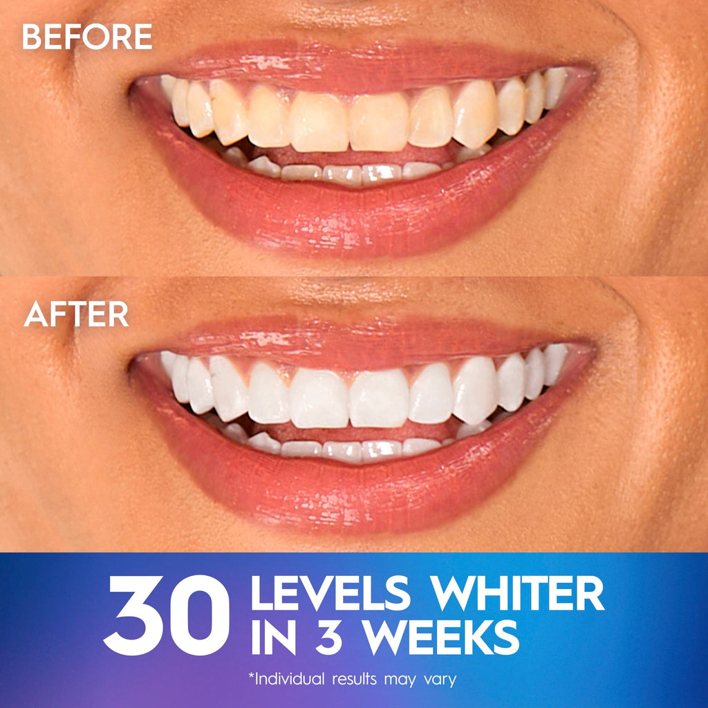Crest 3DWhitestrips at Home Teeth Whitening Kit, Professional Express + Whitening Light, 1 Light + 19 Treatments, 38 Strips