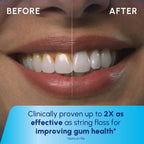 Waterpik Cordless 1200 Water Flosser with 2 Settings, 2 Tips, ADA Accepted